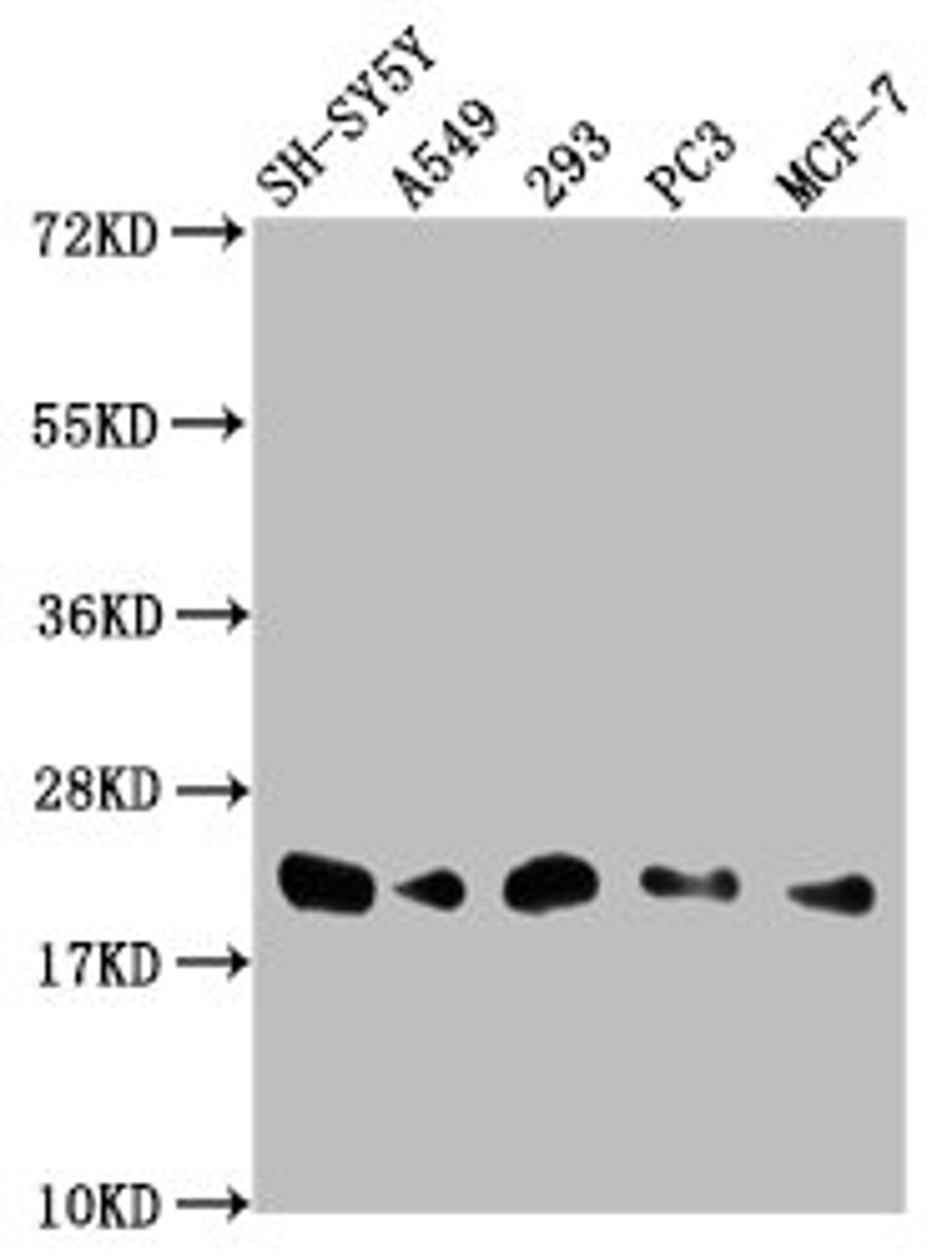 Western Blot. Positive WB detected in: SH-SY5Y whole cell lysate, A549 whole cell lysate, 293 whole cell lysate, PC-3 whole cell lysate, MCF-7 whole cell lysate. All lanes: ITGB1BP1 antibody at 1:2000. Secondary. Goat polyclonal to rabbit IgG at 1/50000 dilution. Predicted band size: 22, 17 kDa. Observed band size: 22 kDa