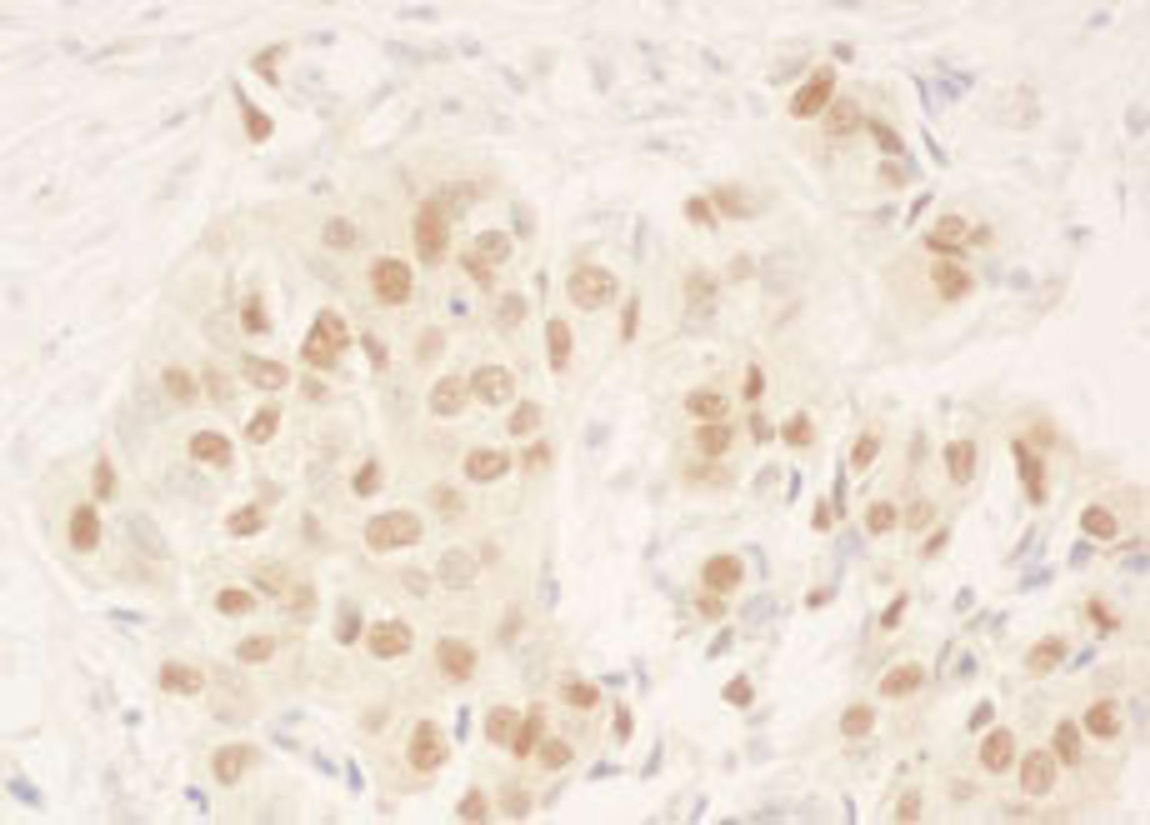 Detection of human NRIP by immunohistochemistry.