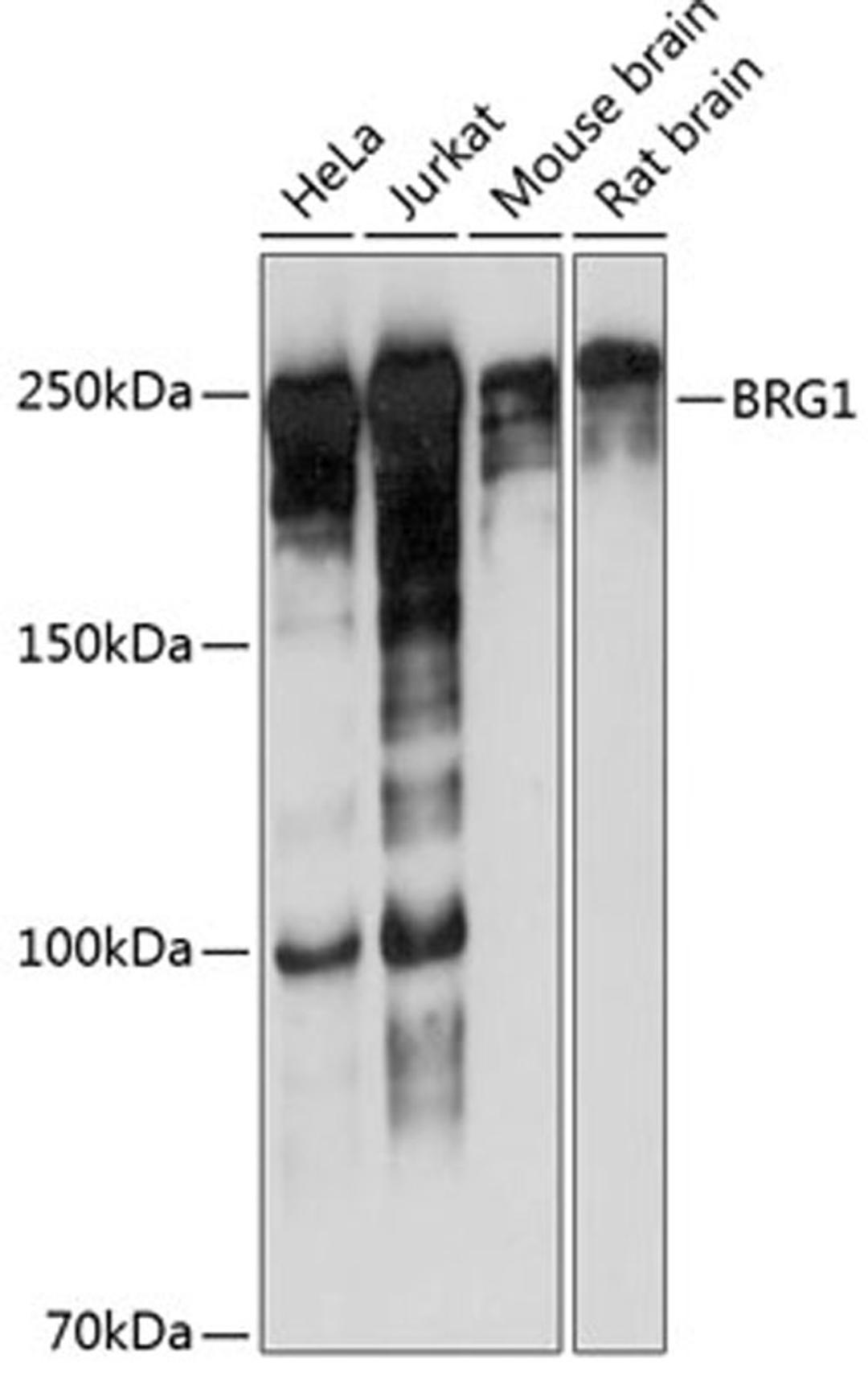 Western blot - BRG1 antibody (A19556)