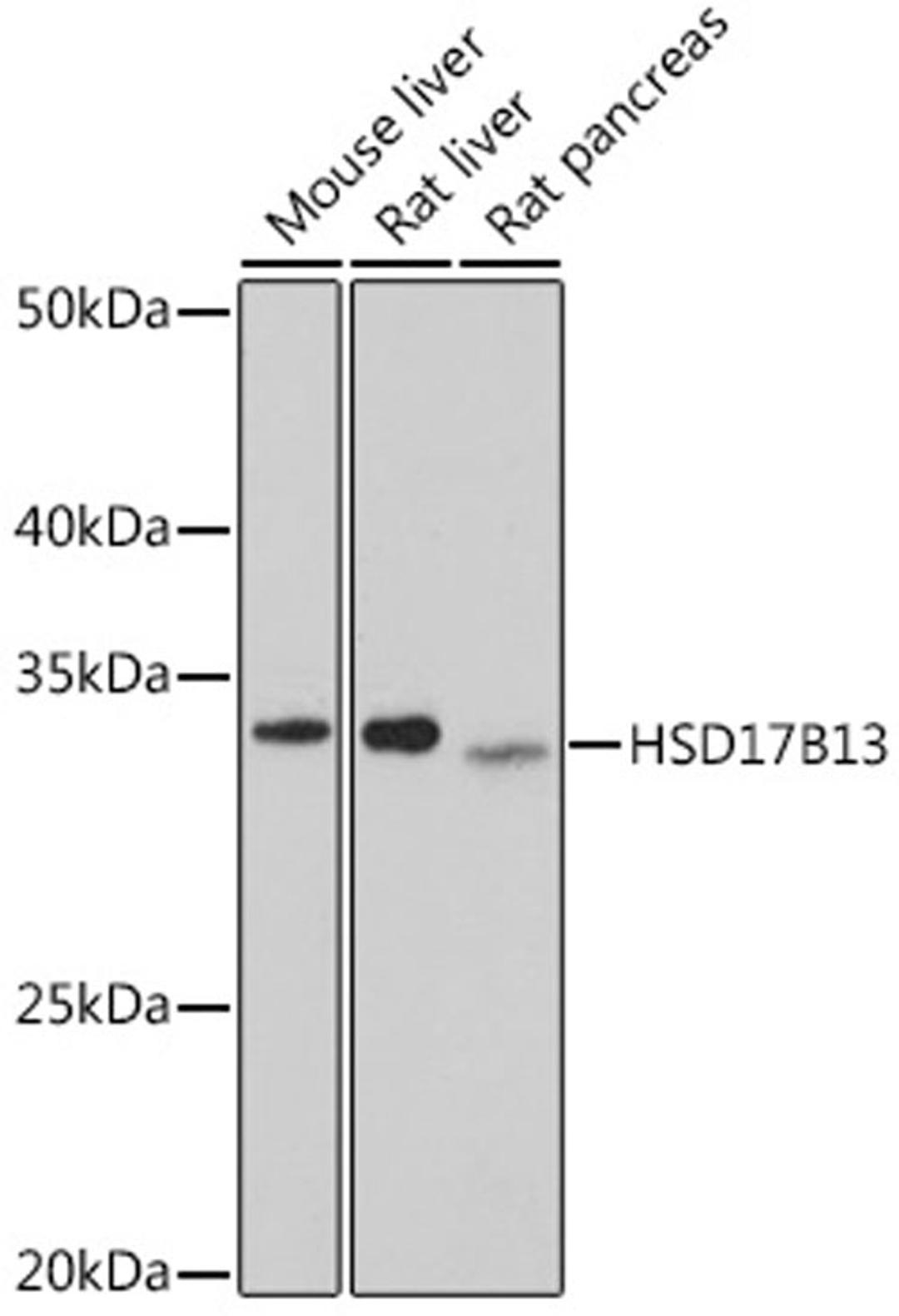 Western blot - HSD17B13 antibody (A6256)