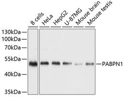 Western blot - PABPN1 antibody (A6041)