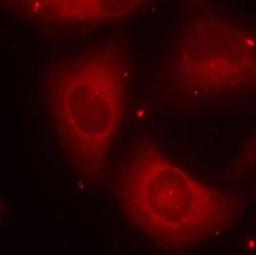 Immunocytochemistry/Immunofluorescence: LIM kinase 2 [p Thr505] Antibody [NB100-82023] - Staining of methanol-fixed Hela cells using LIM kinase 2 [p Thr505] Antibody.