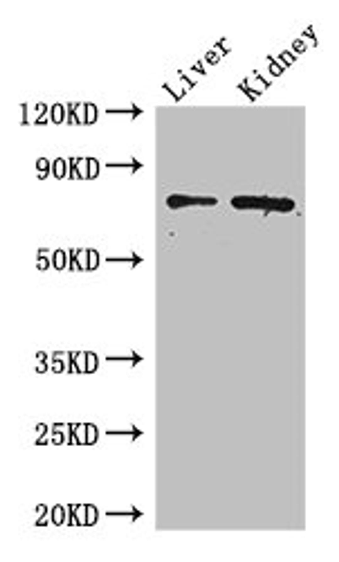 Western Blot. Positive WB detected in: Mouse liver tissue, Mouse kidney tissue. All lanes: ZFP64 antibody at 4µg/ml. Secondary. Goat polyclonal to rabbit IgG at 1/50000 dilution. Predicted band size: 75, 69, 73, 49, 47 kDa. Observed band size: 75 kDa