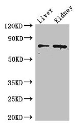 Western Blot. Positive WB detected in: Mouse liver tissue, Mouse kidney tissue. All lanes: ZFP64 antibody at 4µg/ml. Secondary. Goat polyclonal to rabbit IgG at 1/50000 dilution. Predicted band size: 75, 69, 73, 49, 47 kDa. Observed band size: 75 kDa
