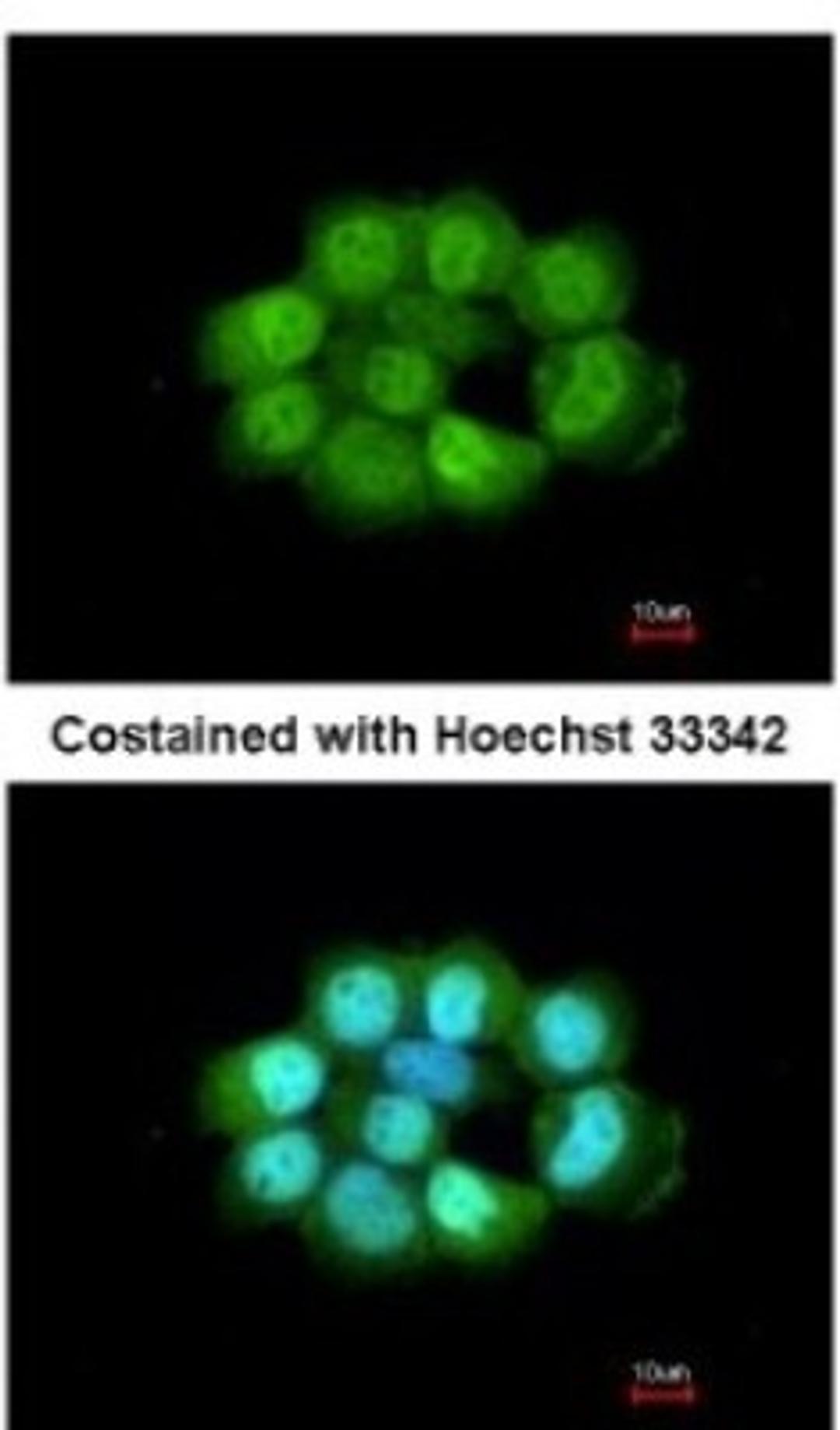 Immunocytochemistry/Immunofluorescence: NOSIP Antibody [NBP2-19566] - Analysis of paraformaldehyde-fixed A431, using antibody at 1:200 dilution.