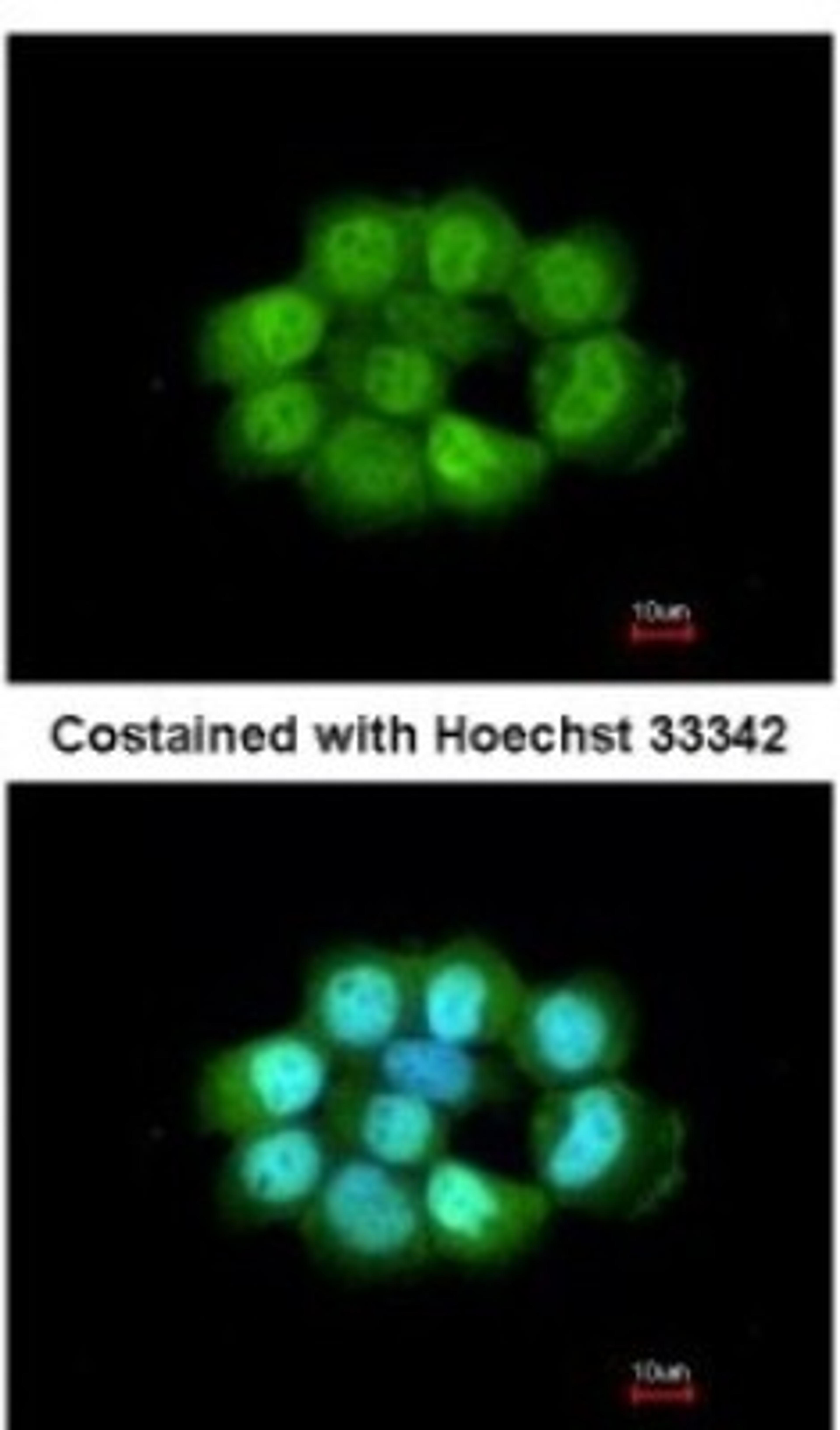 Immunocytochemistry/Immunofluorescence: NOSIP Antibody [NBP2-19566] - Analysis of paraformaldehyde-fixed A431, using antibody at 1:200 dilution.