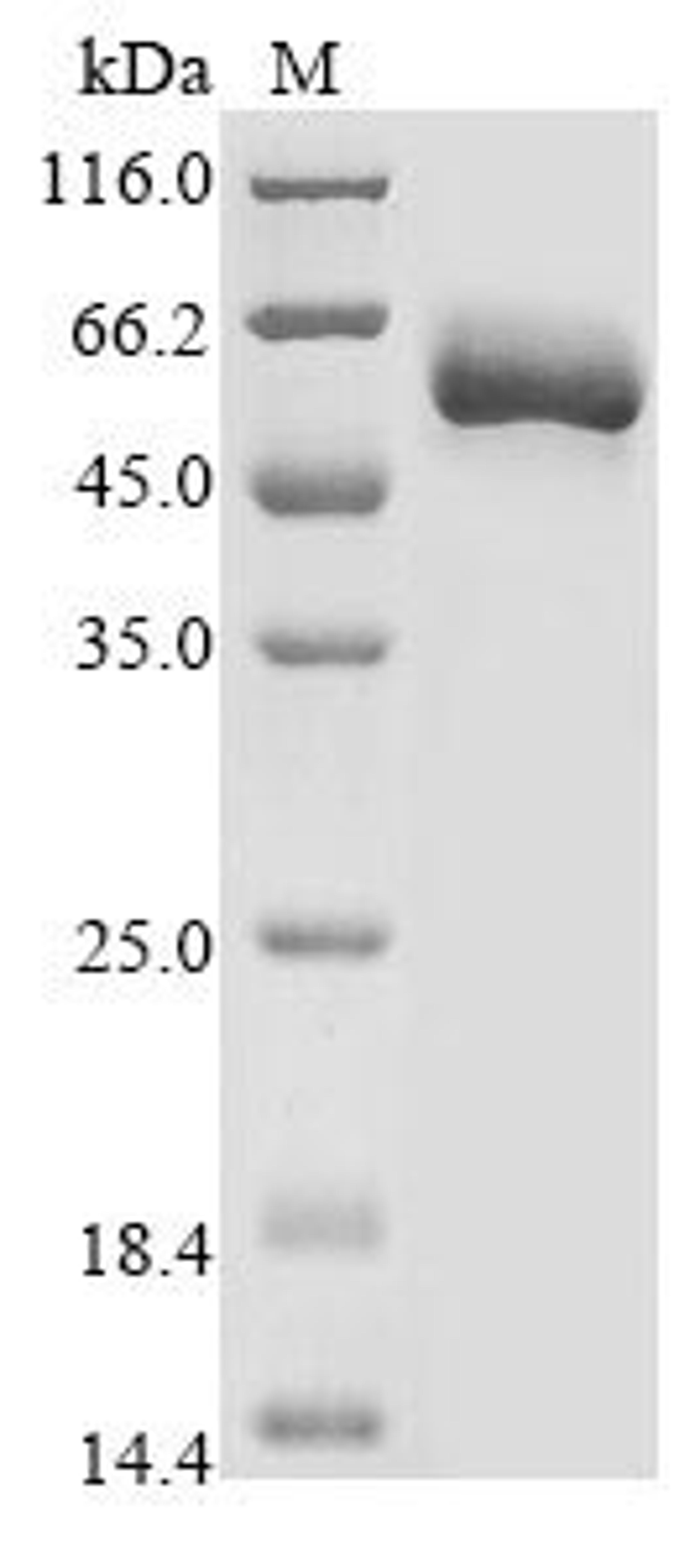 (Tris-Glycine gel) Discontinuous SDS-PAGE (reduced) with 5% enrichment gel and 15% separation gel.
