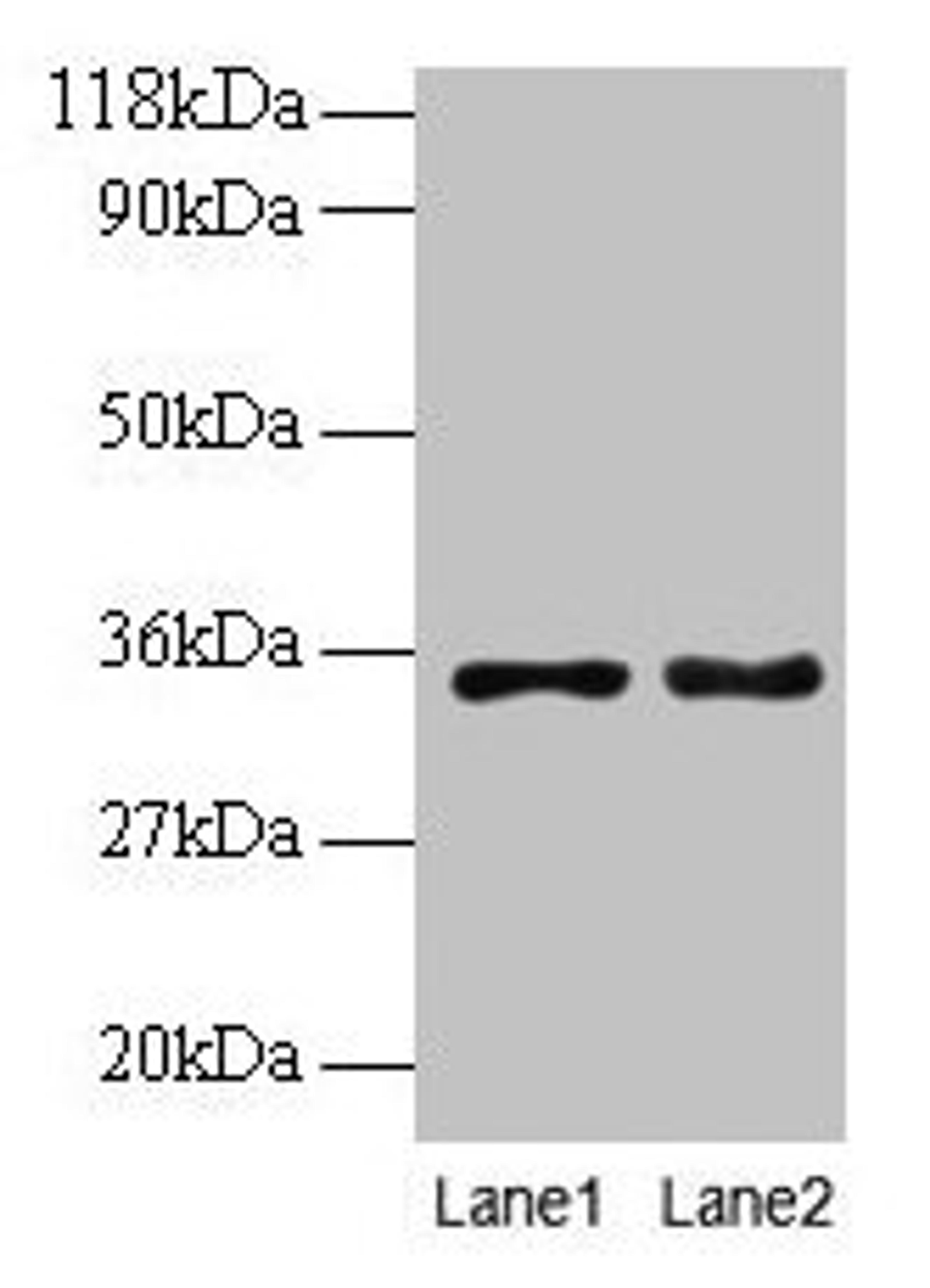 Western blot. All lanes: PTDSS1 antibody at 2µg/ml. Lane 1: EC109 whole cell lysate. Lane 2: 293T whole cell lysate. Secondary. Goat polyclonal to rabbit IgG at 1/15000 dilution. Predicted band size: 56, 39, 35 kDa. Observed band size: 35 kDa