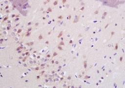 Immunohistochemical analysis of formalin-fixed paraffin embedded rat brain tissue using SHANK3 antibody (dilution at 1:200)