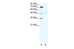 Antibody used in WB on Human HepG2 at 2.5 ug/ml.