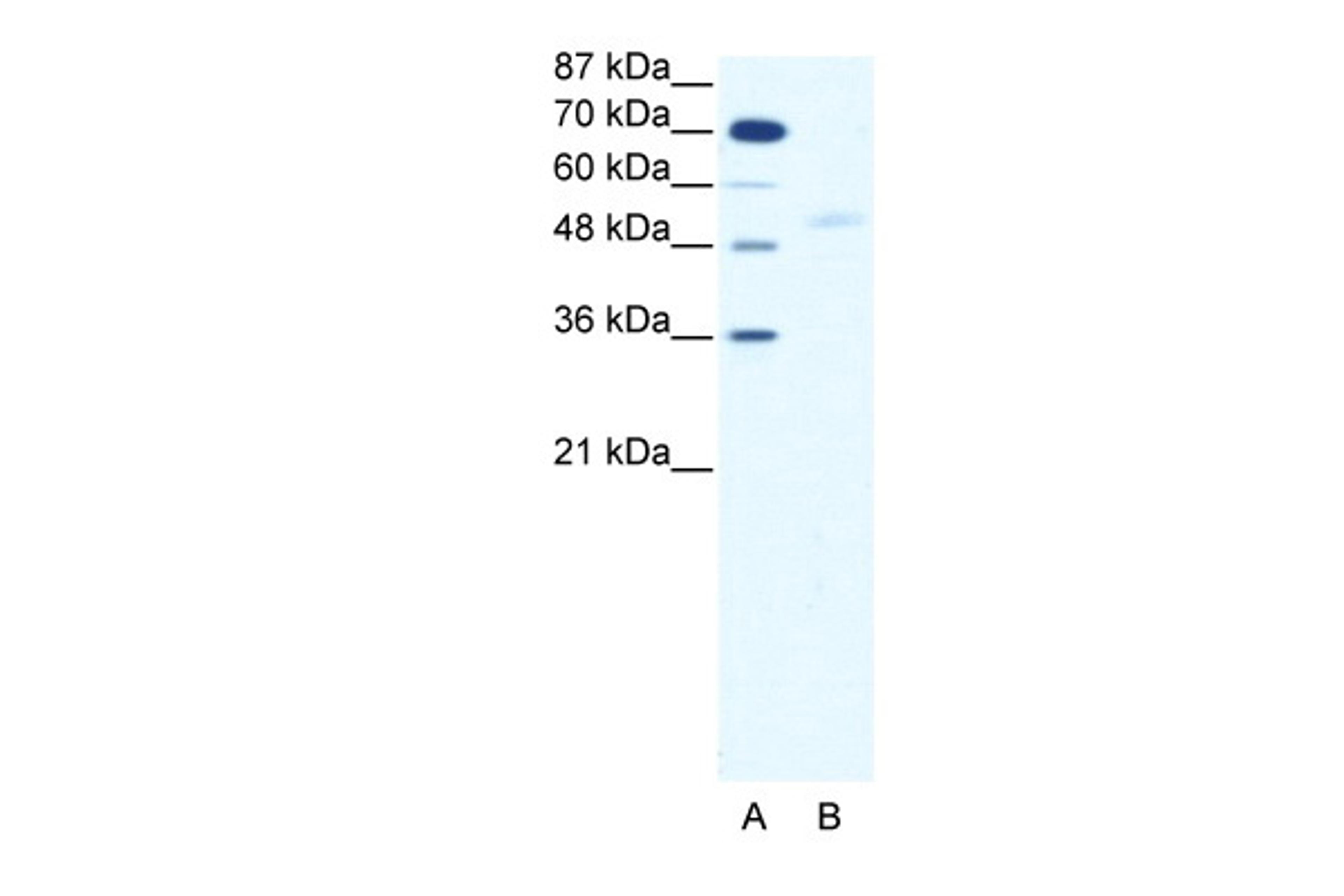 Antibody used in WB on Human HepG2 at 2.5 ug/ml.