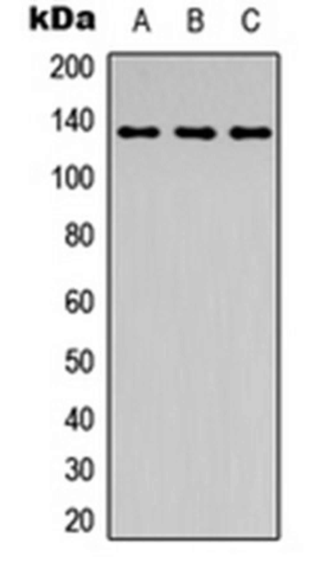 Western blot analysis of HeLa colchicine-treated (Lane 1), mouse kidney (Lane 2), PC12 colchicine-treated (Lane 3) whole cell lysates using ABL1 (phospho-Y204) antibody