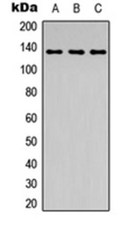 Western blot analysis of HeLa colchicine-treated (Lane 1), mouse kidney (Lane 2), PC12 colchicine-treated (Lane 3) whole cell lysates using ABL1 (phospho-Y204) antibody