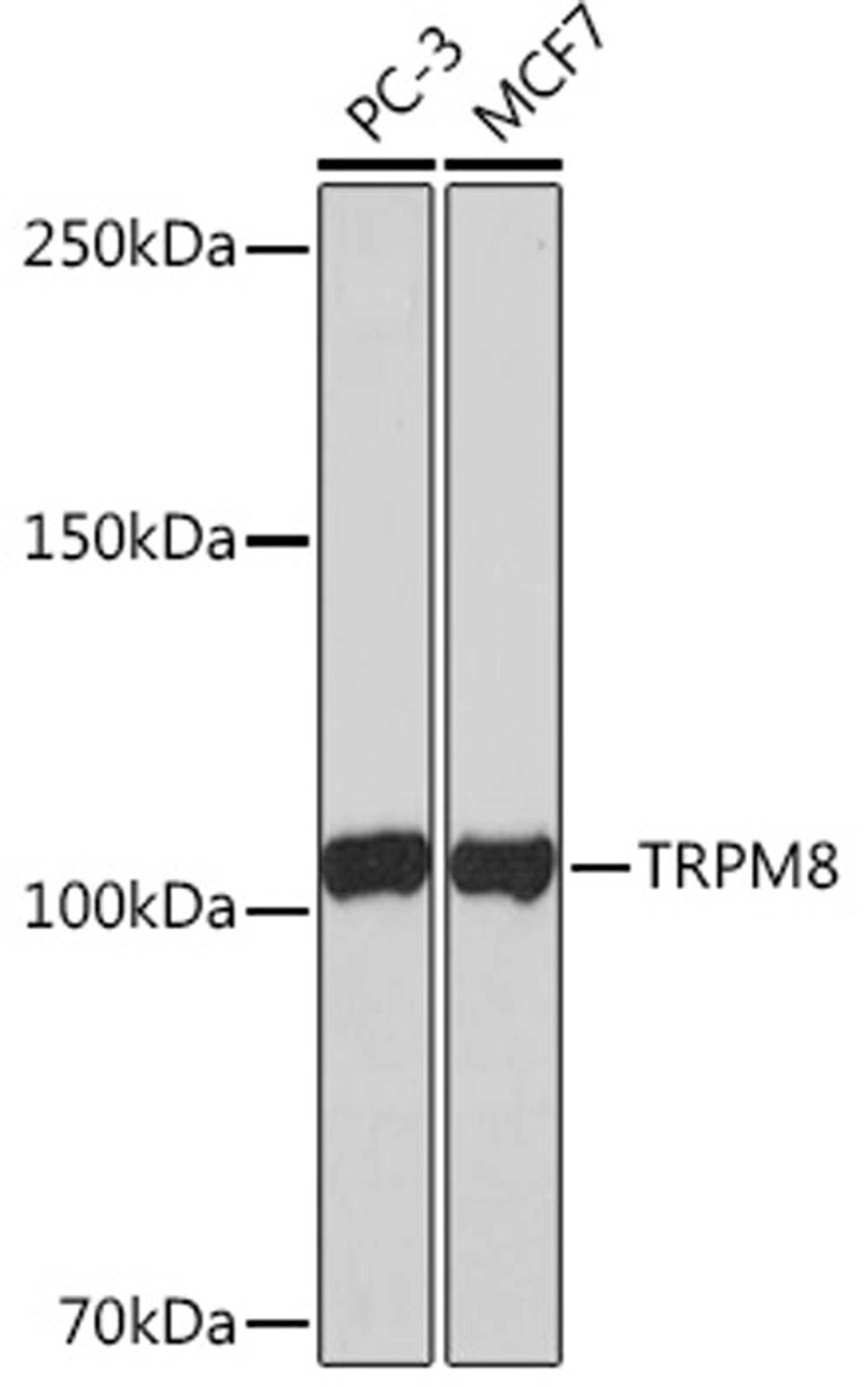 Western blot - TRPM8  Rabbit mAb (A4269)