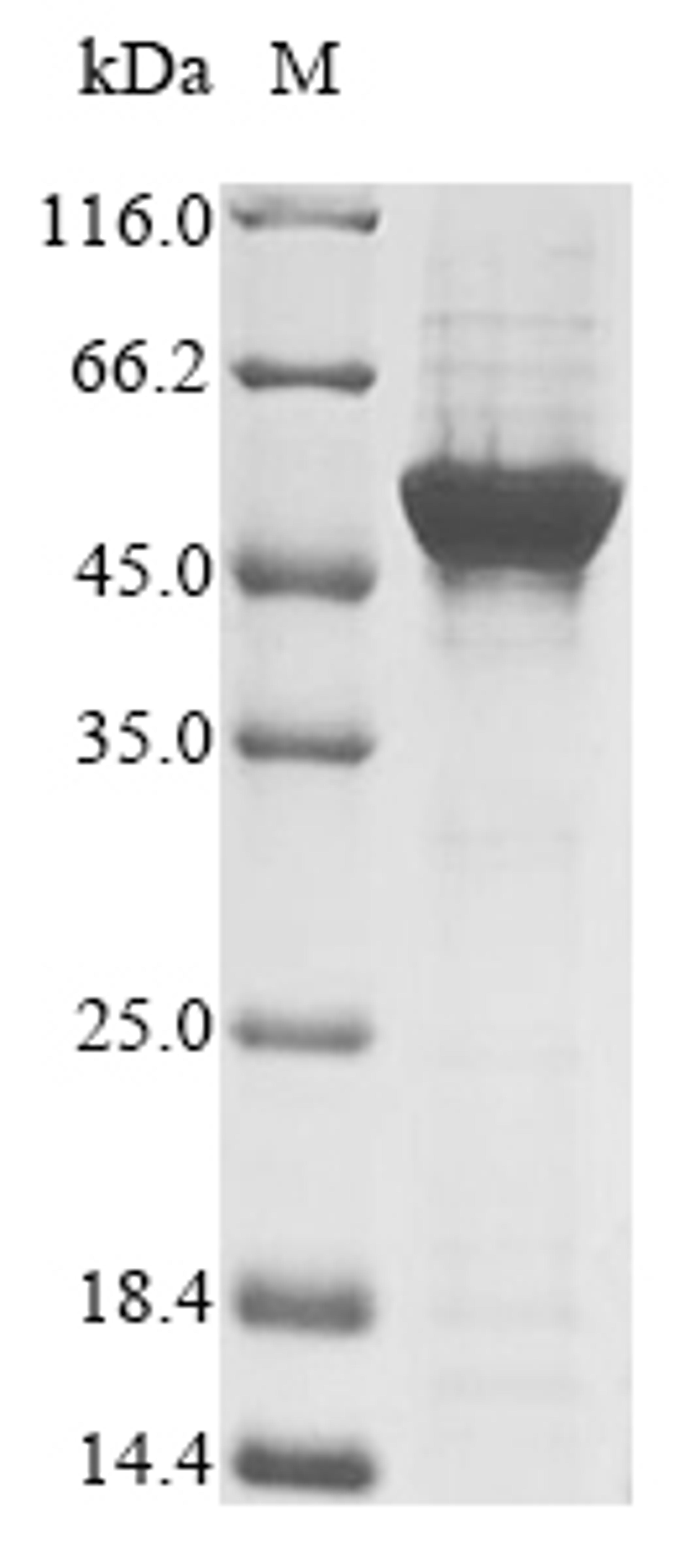 (Tris-Glycine gel) Discontinuous SDS-PAGE (reduced) with 5% enrichment gel and 15% separation gel.