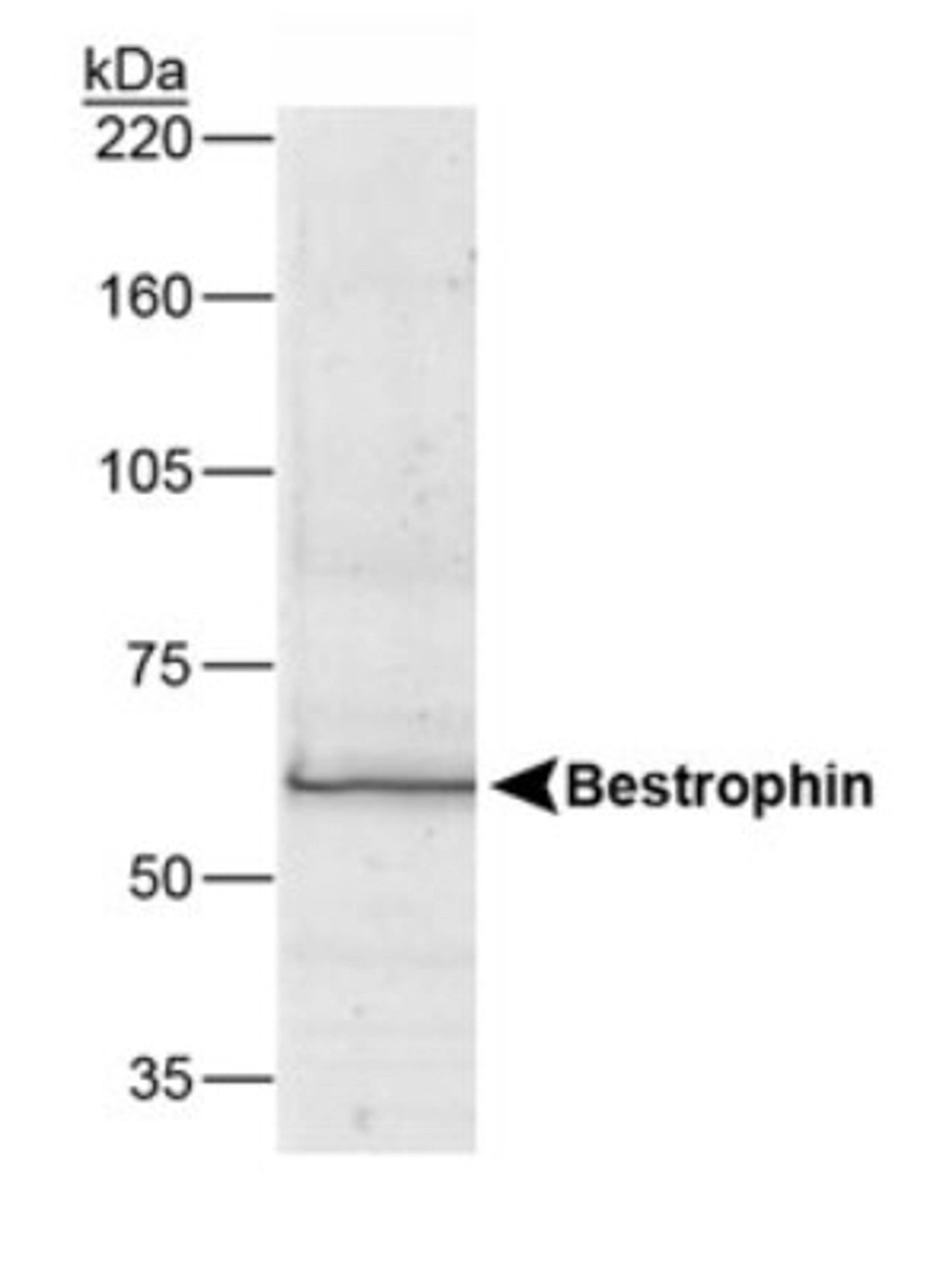 Western Blot: Bestrophin 1 Antibody (E6-6) [NB300-164] - Detection of Bestrophin (68 kDa) from human RPE cell lysate.