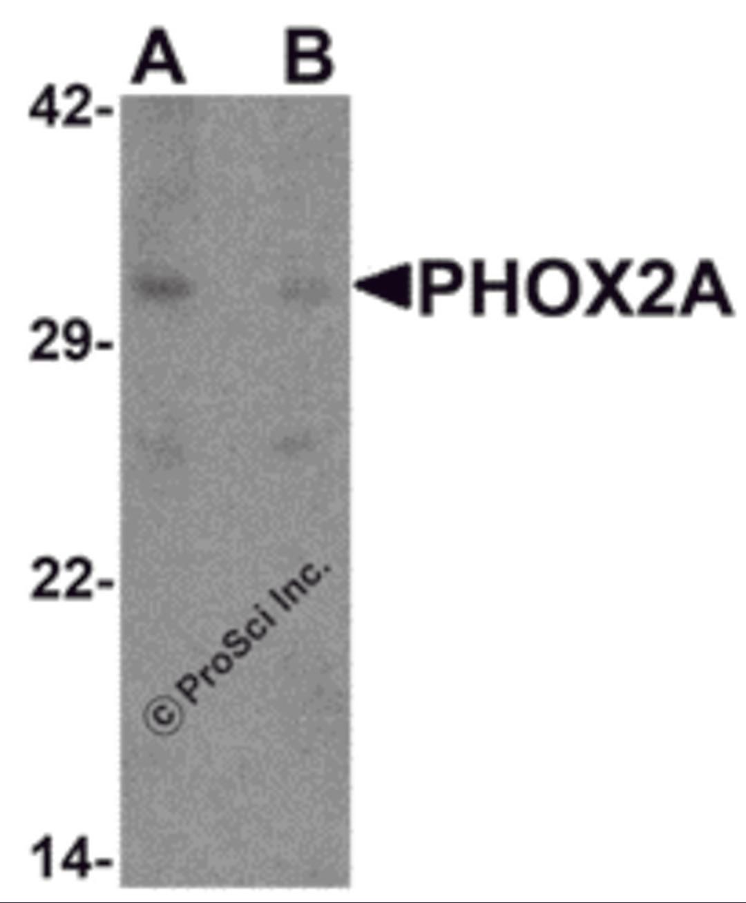 Western blot analysis of PHOX2A in rat brain tissue lysate with PHOX2A antibody at 1 μg/ml in (A) the absence and (B) the presence of blocking peptide.