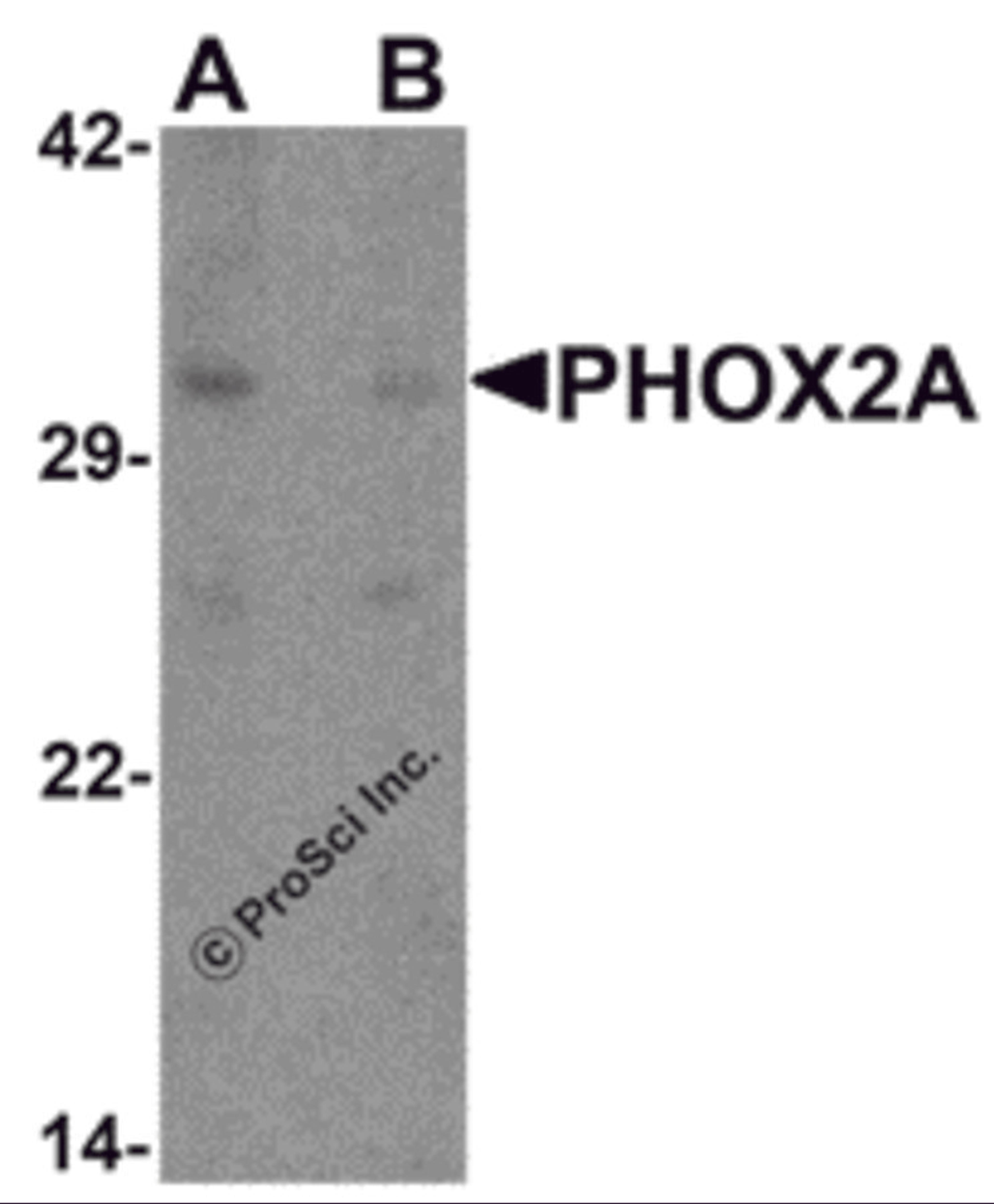 Western blot analysis of PHOX2A in rat brain tissue lysate with PHOX2A antibody at 1 μg/ml in (A) the absence and (B) the presence of blocking peptide.