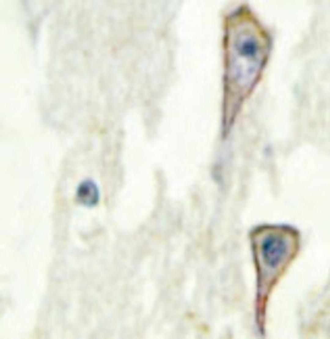 Immunohistochemistry-Paraffin: Adenylate Cyclase 1 Antibody [NBP1-19628] - Paraffin-embedded human brain tissue.