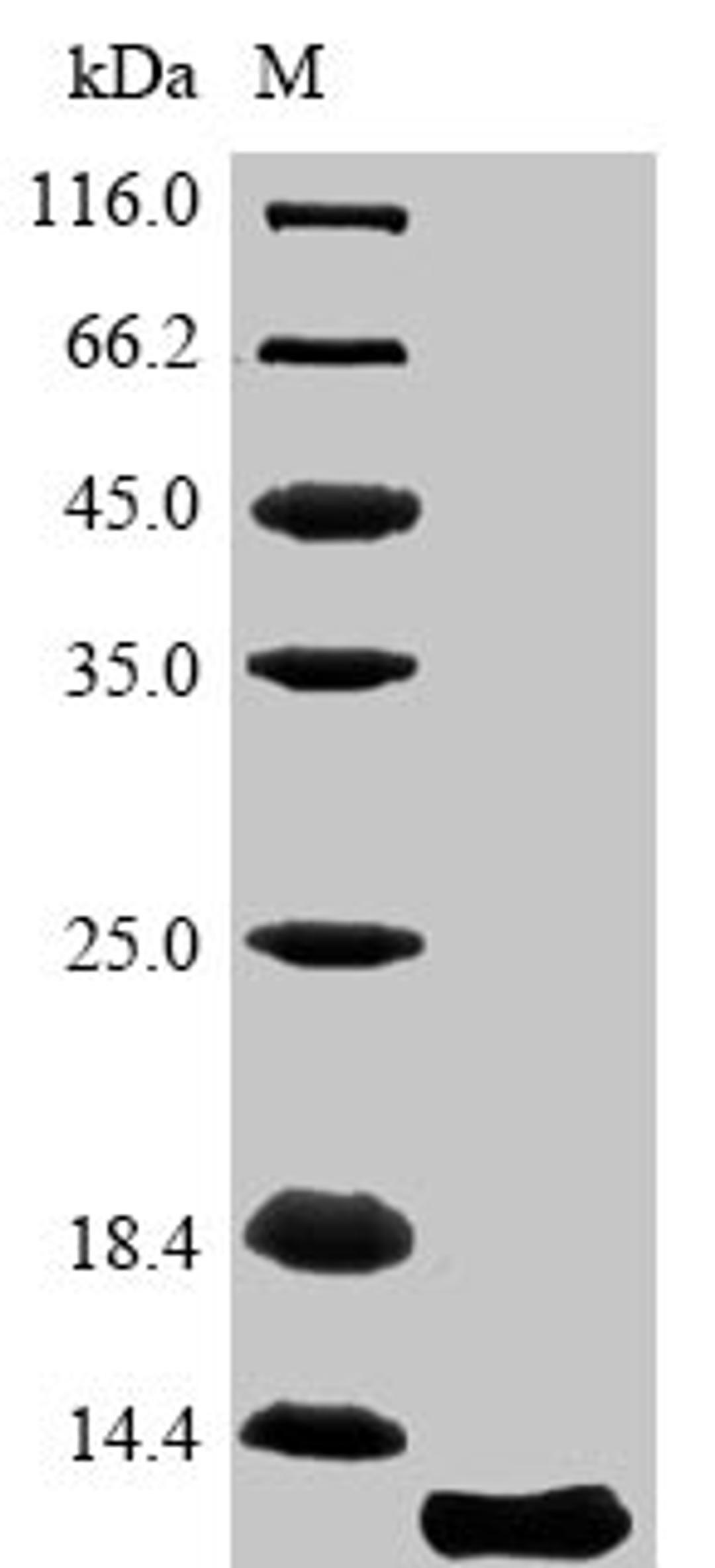 (Tris-Glycine gel) Discontinuous SDS-PAGE (reduced) with 5% enrichment gel and 15% separation gel.