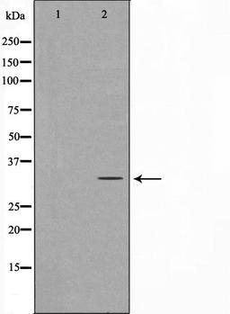 Western blot analysis of HeLa cell lysate using Neuro D antibody