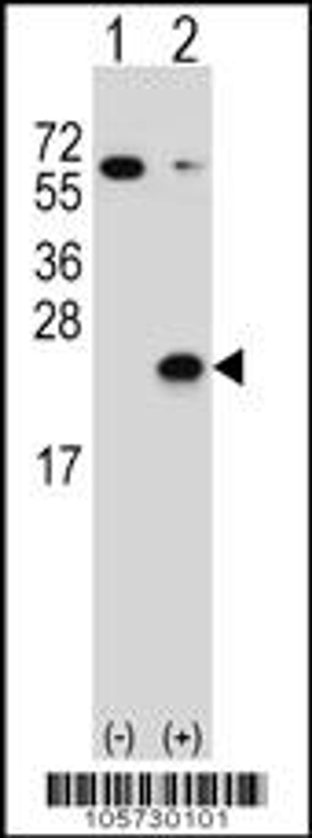 Western blot analysis of DUSP3 using rabbit polyclonal DUSP3 Antibody (C171) using 293 cell lysates (2 ug/lane) either nontransfected (Lane 1) or transiently transfected (Lane 2) with the DUSP3 gene.