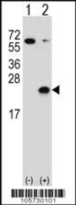 Western blot analysis of DUSP3 using rabbit polyclonal DUSP3 Antibody (C171) using 293 cell lysates (2 ug/lane) either nontransfected (Lane 1) or transiently transfected (Lane 2) with the DUSP3 gene.