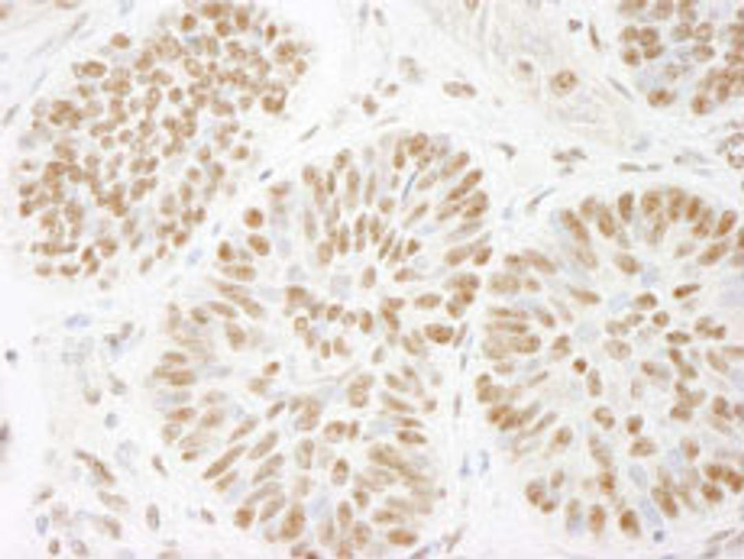 Detection of human ACINUS/ACN1 by immunohistochemistry.