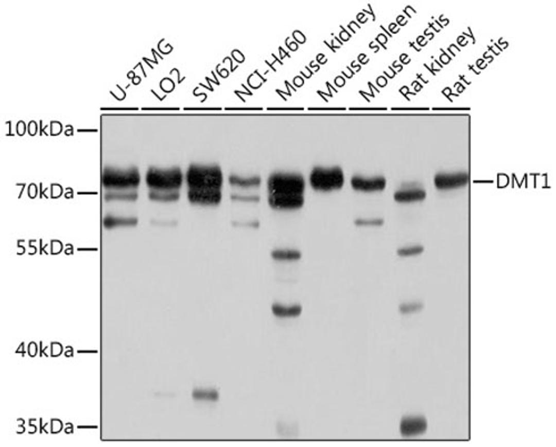 Western blot - DMT1 antibody (A10231)