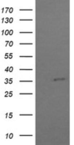 Western Blot: COPS6 Antibody (4E7) [NBP2-46333] - Analysis of HEK293T cells were transfected with the pCMV6-ENTRY control (Left lane) or pCMV6-ENTRY COPS6.