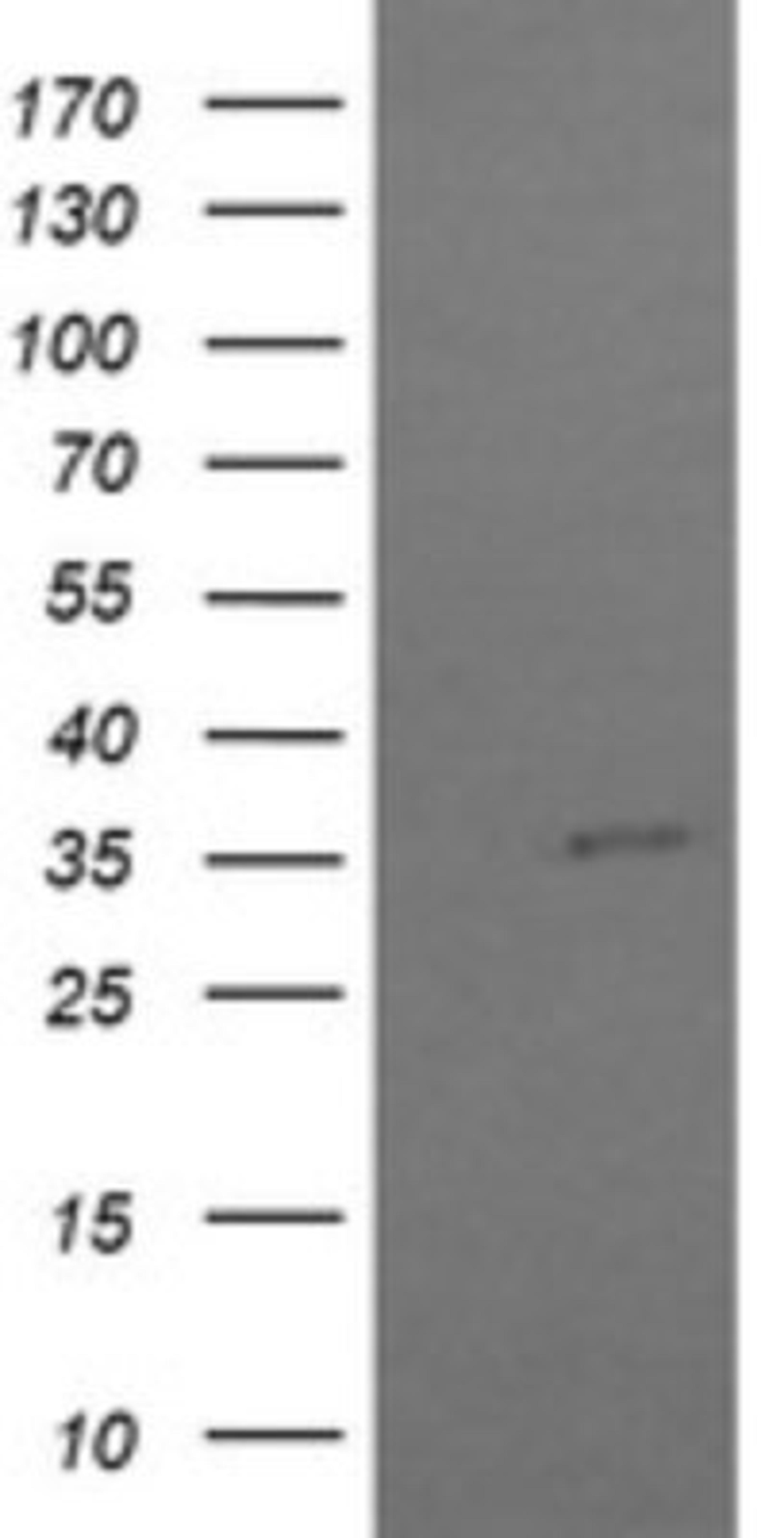 Western Blot: COPS6 Antibody (4E7) [NBP2-46333] - Analysis of HEK293T cells were transfected with the pCMV6-ENTRY control (Left lane) or pCMV6-ENTRY COPS6.