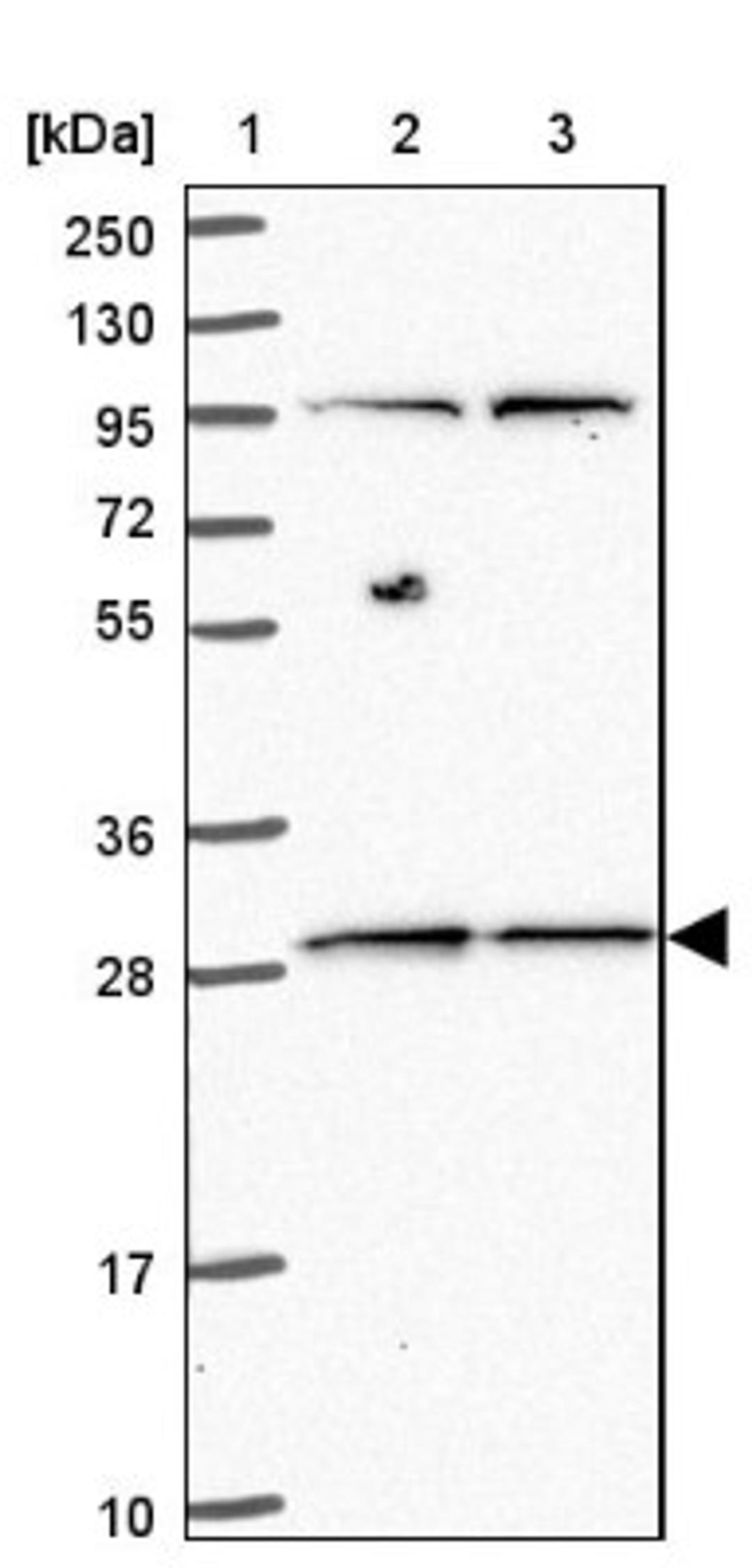 Western Blot: MRPL46 Antibody [NBP2-47369] - Lane 1: Marker [kDa] 250, 130, 95, 72, 55, 36, 28, 17, 10.  Lane 2: Human cell line RT-4.  Lane 3: Human cell line U-251MG.