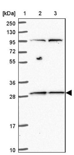 Western Blot: MRPL46 Antibody [NBP2-47369] - Lane 1: Marker [kDa] 250, 130, 95, 72, 55, 36, 28, 17, 10.  Lane 2: Human cell line RT-4.  Lane 3: Human cell line U-251MG.