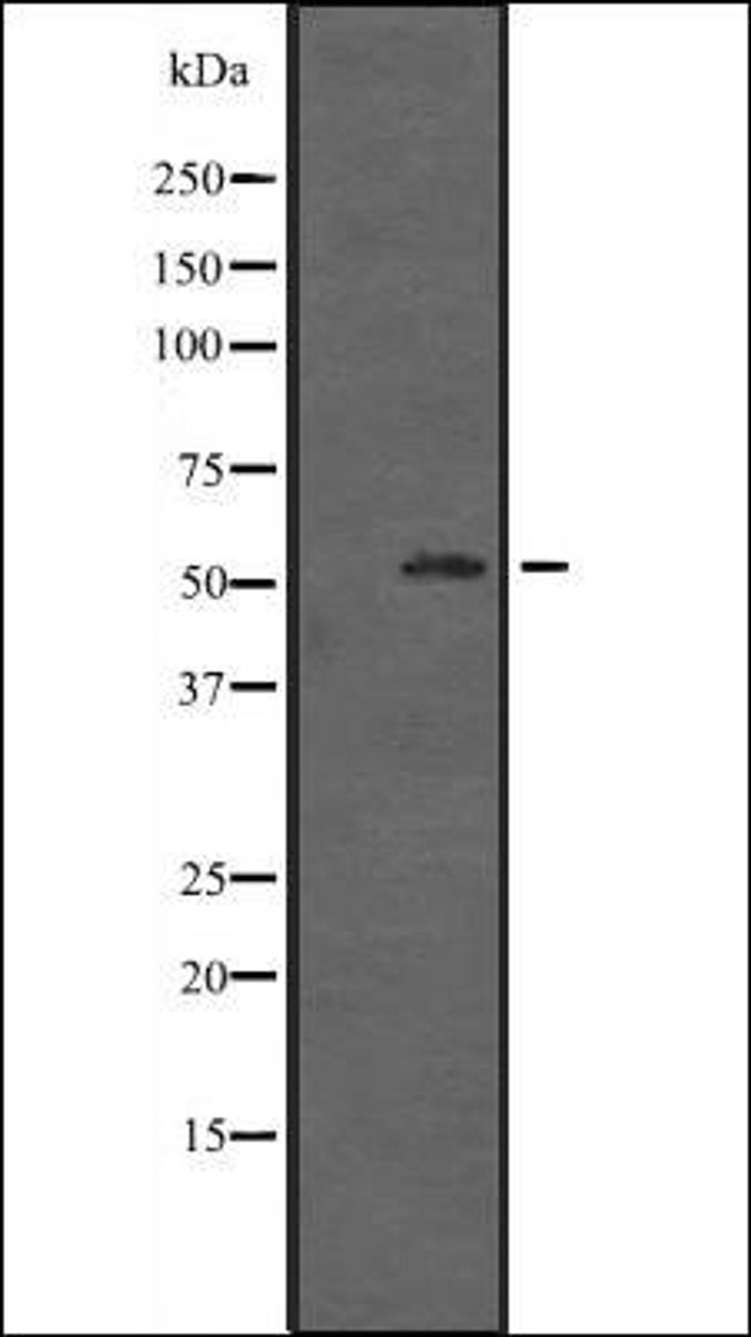 Western blot analysis of HepG2 cell lysate using ZNF440 antibody