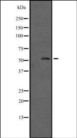 Western blot analysis of HepG2 cell lysate using ZNF440 antibody