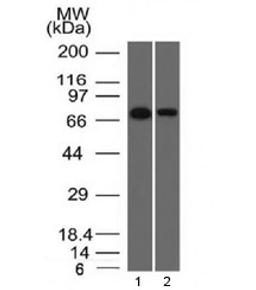 Western blot testing of human 1) HeLa and 2) A431 cell lysate with Endoglin antibody (clone ENG/1327).  Observed molecular weight: 70/90 kDa (monomer, unmodified/glycosylated); 140-180 kDa (dimer, unmodified/glycosylated).