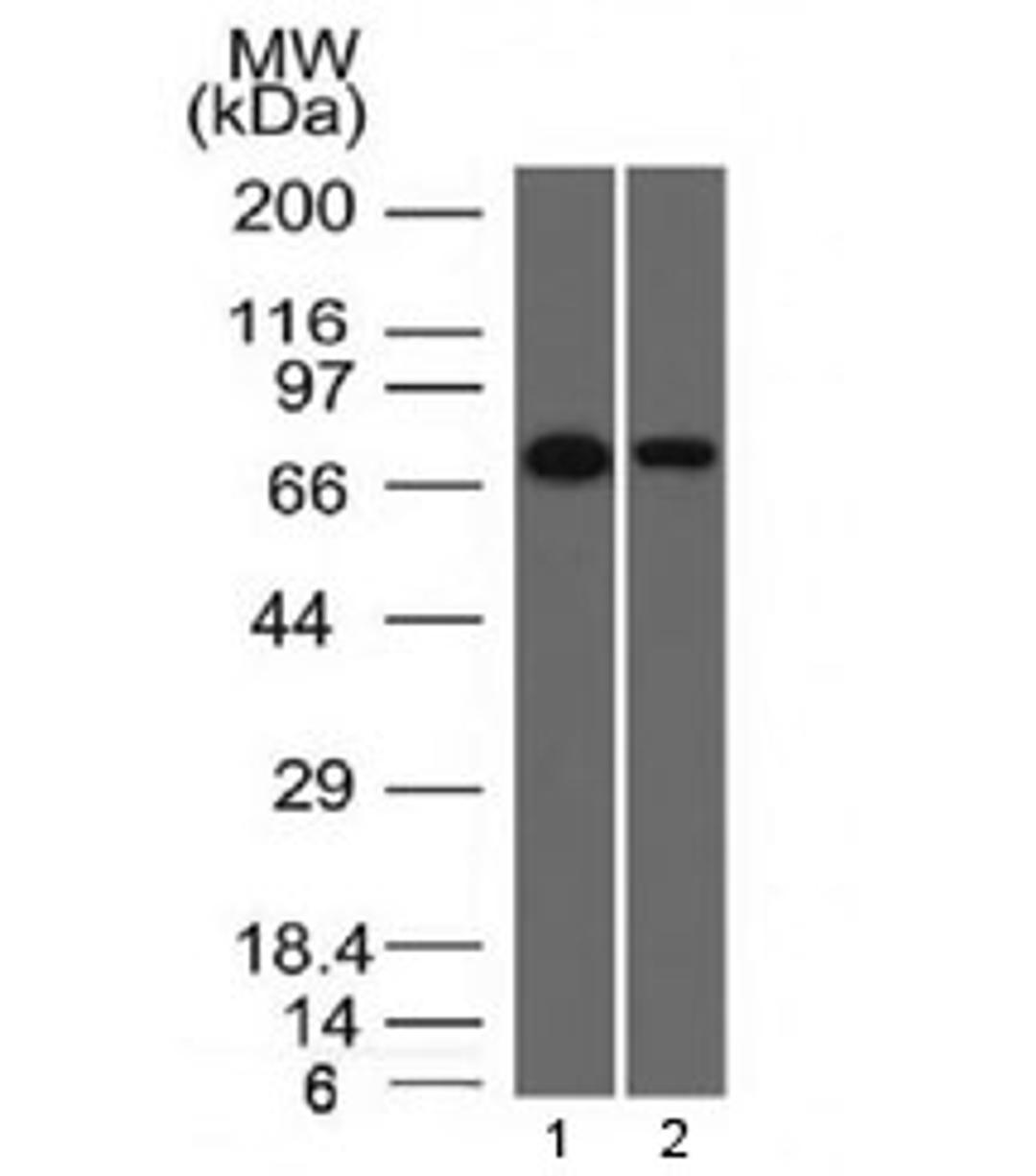 Western blot testing of human 1) HeLa and 2) A431 cell lysate with Endoglin antibody (clone ENG/1327). Observed molecular weight: 70/90 kDa (monomer, unmodified/glycosylated); 140-180 kDa (dimer, unmodified/glycosylated).