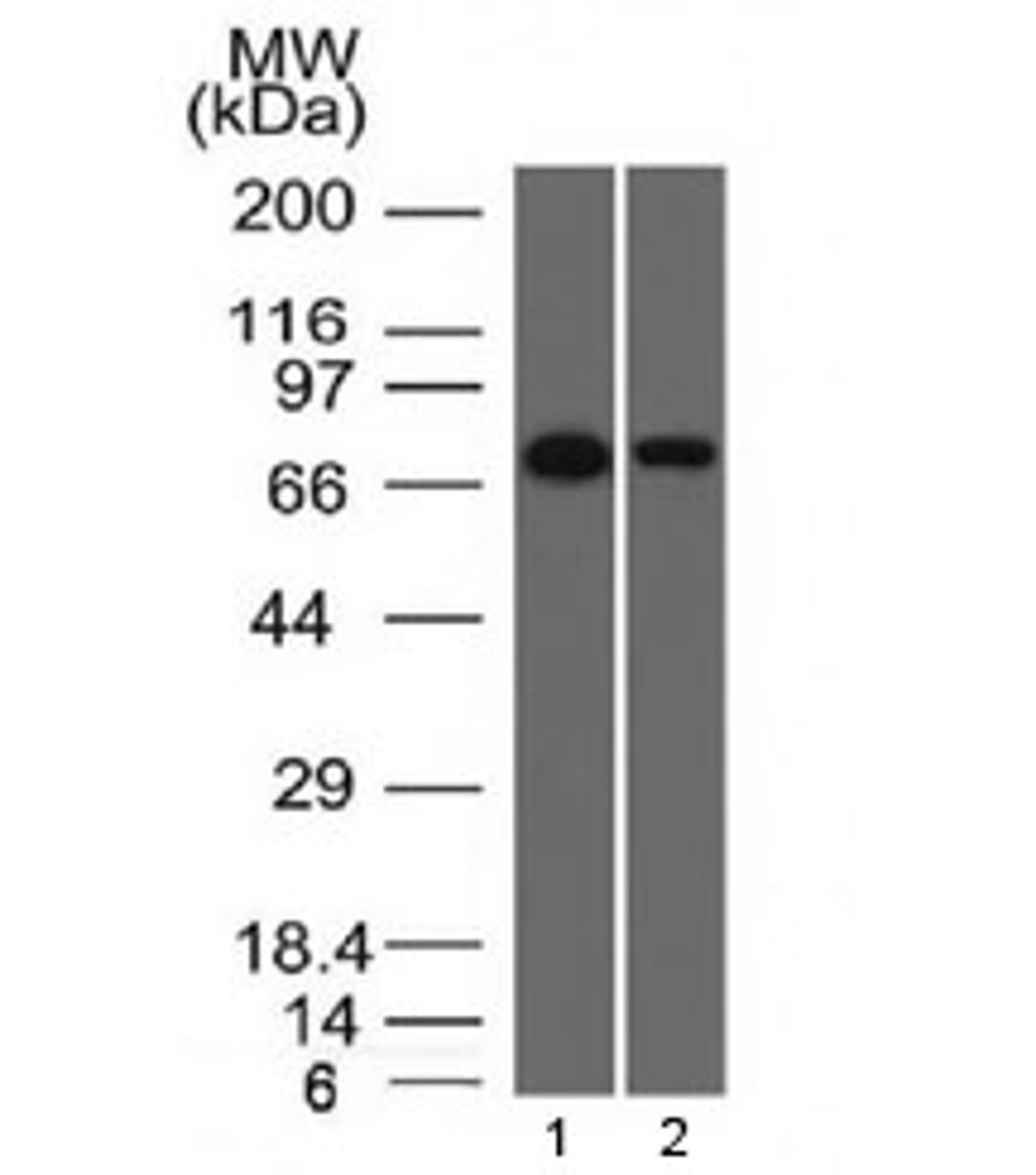 Western blot testing of human 1) HeLa and 2) A431 cell lysate with Endoglin antibody (clone ENG/1327). Observed molecular weight: 70/90 kDa (monomer, unmodified/glycosylated); 140-180 kDa (dimer, unmodified/glycosylated).