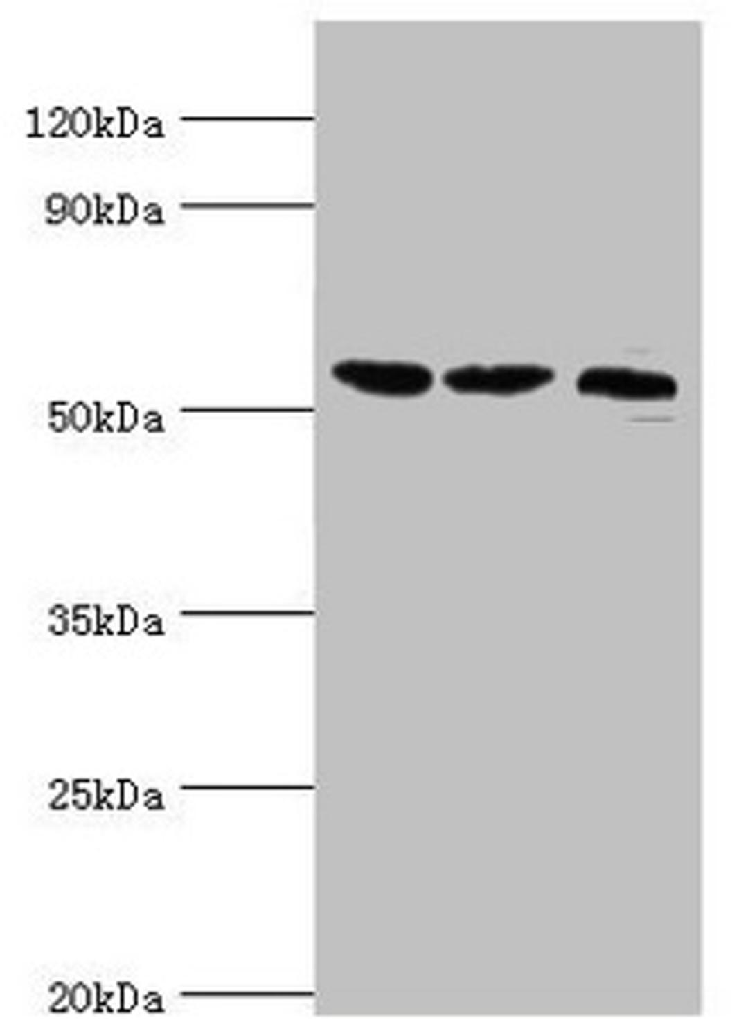 Western blot. All lanes: Histone-lysine N-methyltransferase SMYD1 antibody at 2ug/ml. Lane 1: Mouse heart tissue. Lane 2: 293T whole cell lysate. Lane 3: Mouse skeletal muscle tissue. Secondary. Goat polyclonal to rabbit IgG at 1/10000 dilution. Predicted band size: 57 kDa. Observed band size: 57 kDa.