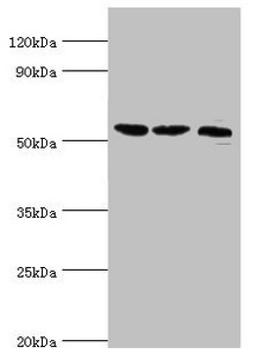 Western blot. All lanes: Histone-lysine N-methyltransferase SMYD1 antibody at 2ug/ml. Lane 1: Mouse heart tissue. Lane 2: 293T whole cell lysate. Lane 3: Mouse skeletal muscle tissue. Secondary. Goat polyclonal to rabbit IgG at 1/10000 dilution. Predicted band size: 57 kDa. Observed band size: 57 kDa.