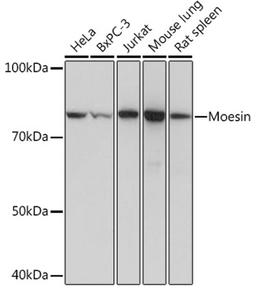 Western blot - Moesin Rabbit mAb (A4915)