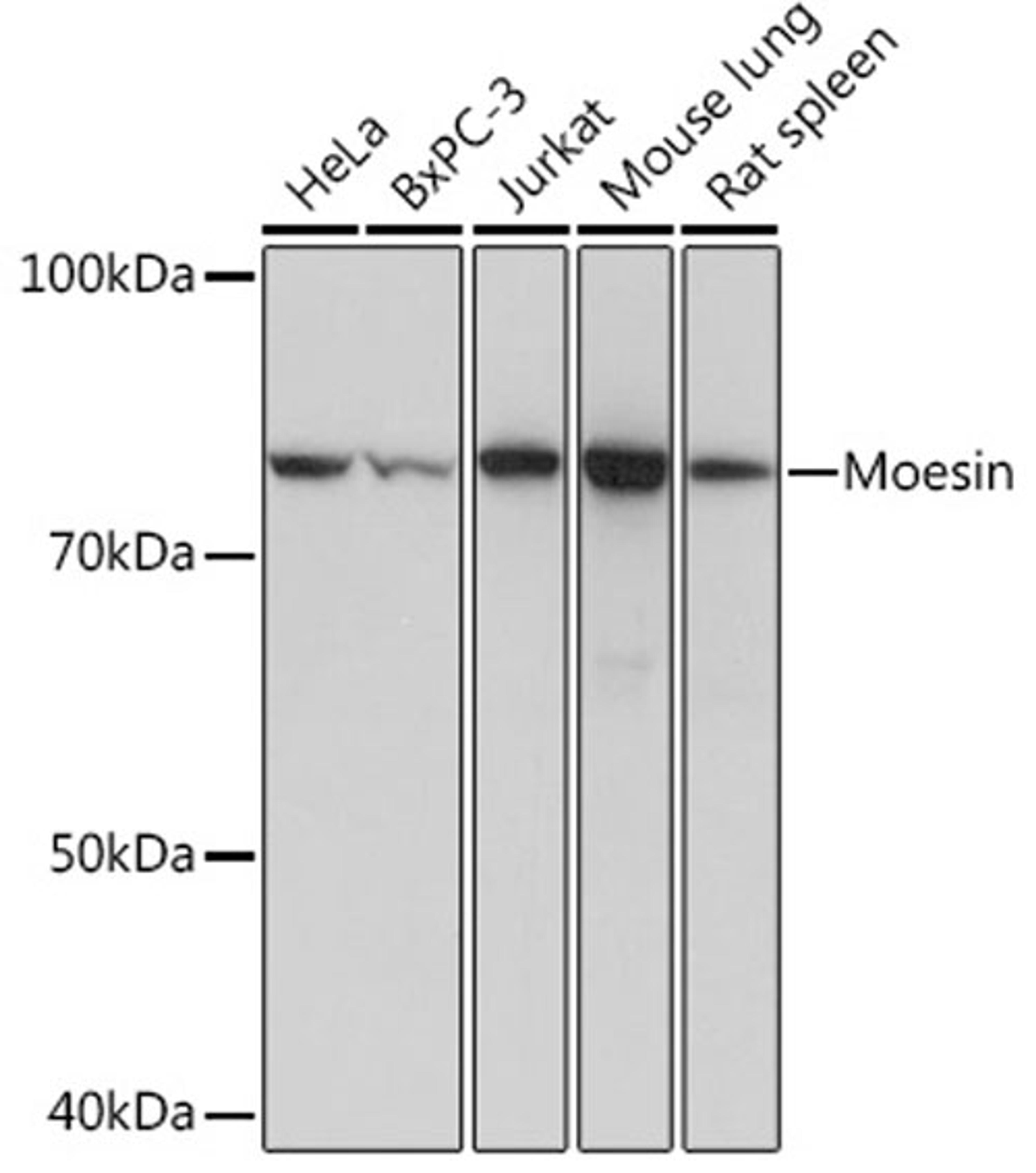 Western blot - Moesin Rabbit mAb (A4915)