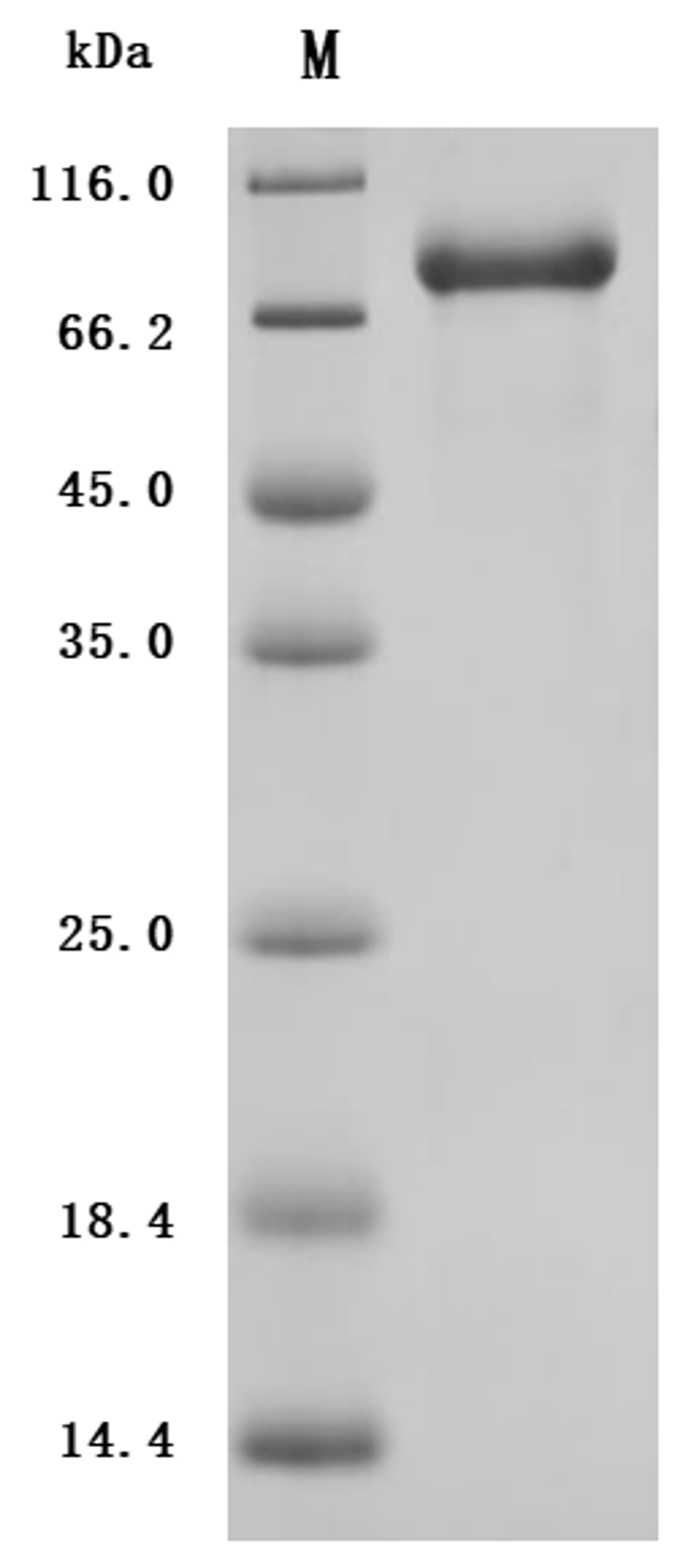 (Tris-Glycine gel) Discontinuous SDS-PAGE (reduced) with 5% enrichment gel and 15% separation gel.