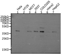 Western blot. All lanes: MRGPRX2 antibody at 5ug/ml. Lane 1: 293T whole cell lysate. Lane 2: Mouse liver tissue. Secondary. Goat polyclonal to rabbit IgG at 1/10000 dilution. Predicted band size: 38 kDa. Observed band size: 38 kDa.