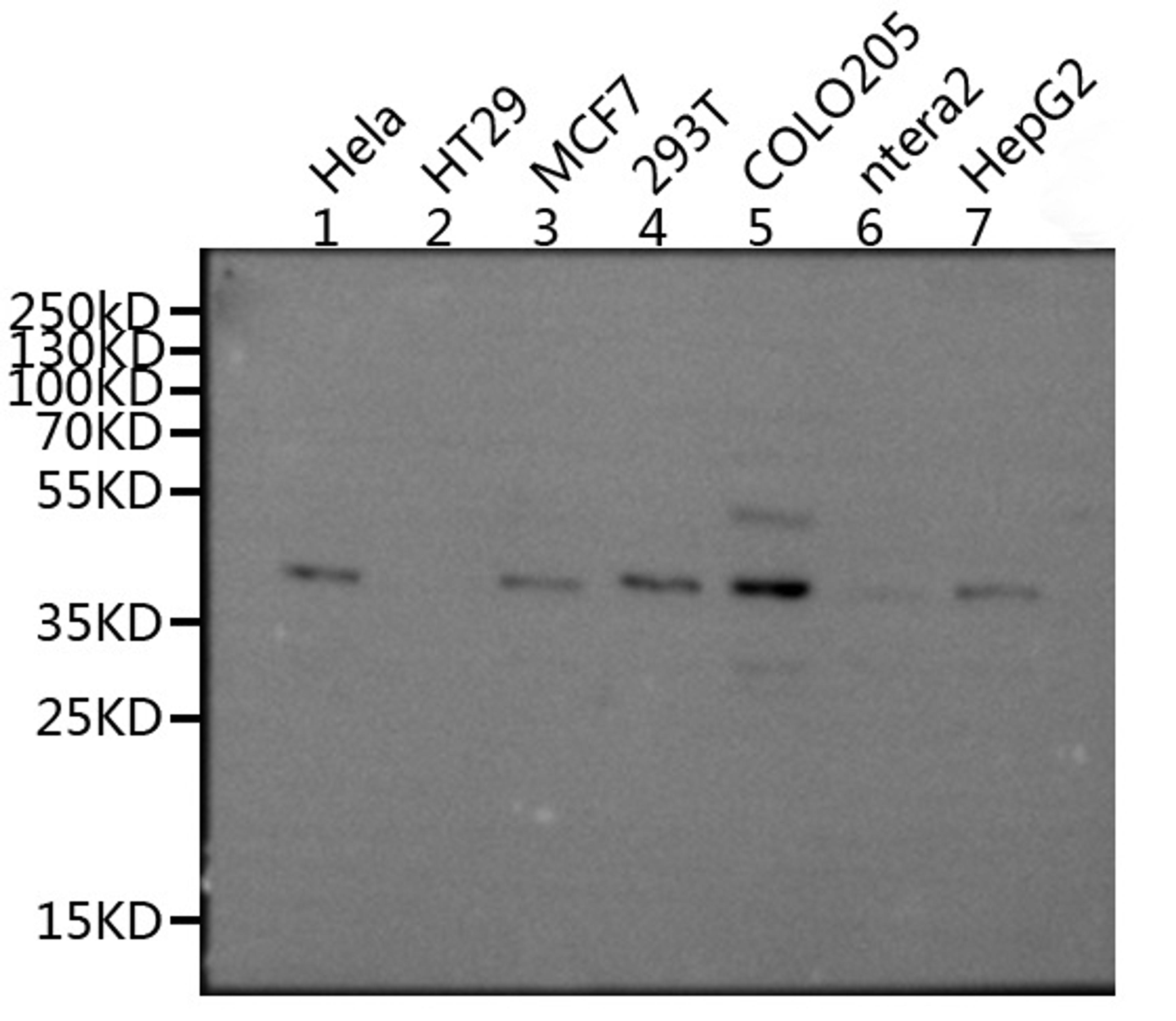Western blot. All lanes: MRGPRX2 antibody at 5ug/ml. Lane 1: 293T whole cell lysate. Lane 2: Mouse liver tissue. Secondary. Goat polyclonal to rabbit IgG at 1/10000 dilution. Predicted band size: 38 kDa. Observed band size: 38 kDa.