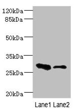 Western blot. All lanes: EAF2 antibody at 3.6ug/ml. Lane 1: Rat heart tissue. Lane 2: Mouse kidney tissue. Secondary. Goat polyclonal to rabbit IgG at 1/10000 dilution. Predicted band size: 29, 15 kDa. Observed band size: 29 kDa.
