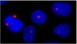 Immunocytochemistry/Immunofluorescence: Pericentrin Antibody [NB100-61071] - NBF-fixed asynchronous HeLa cells.  Affinity purified rabbit anti- Pericentrin/Kendrin used at a dilution of 1:100.