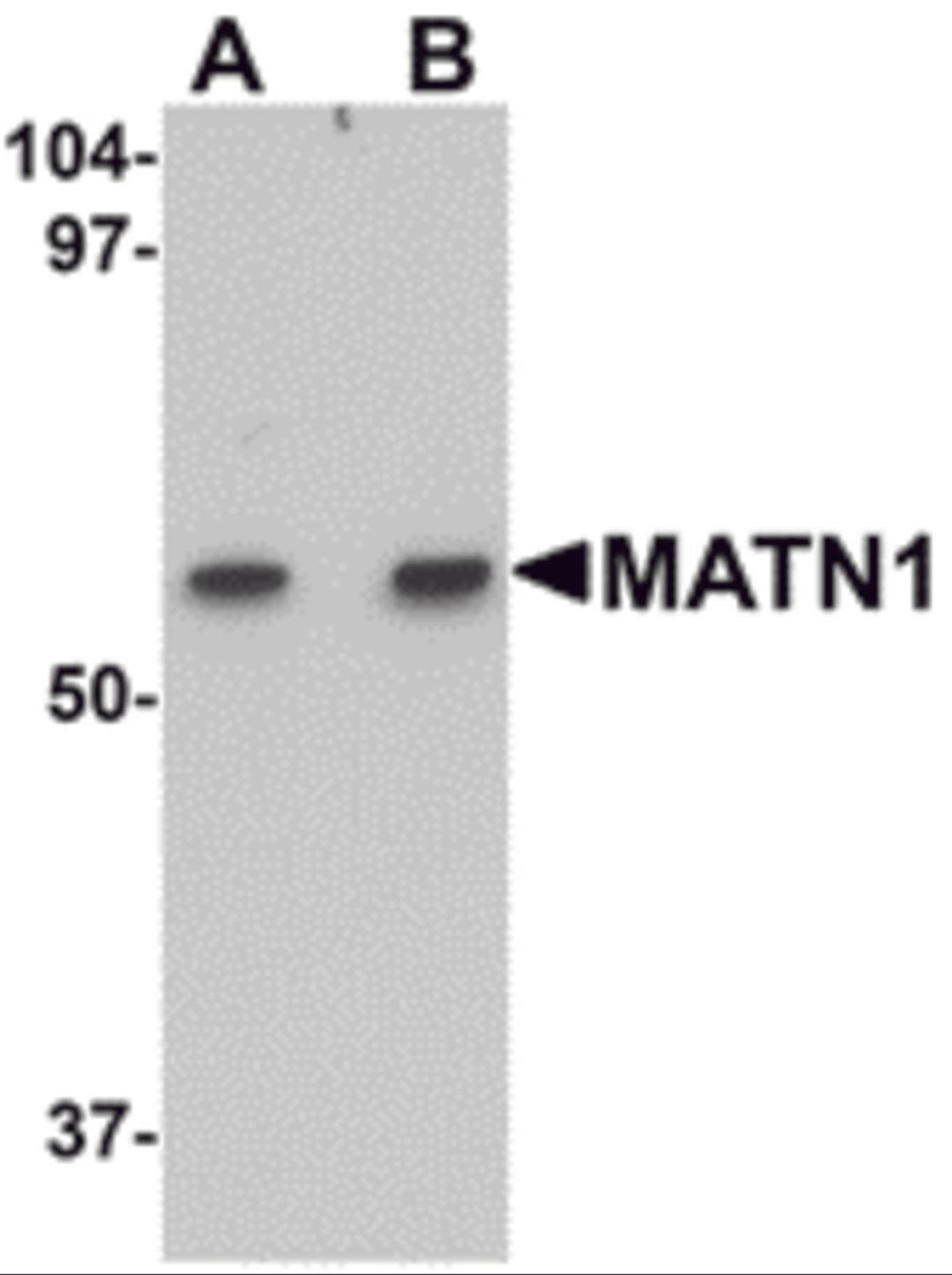 Western blot analysis of MATN1 in rat liver tissue lysate with MATN1 antibody at (A) 1 and (B) 2 μg/mL.