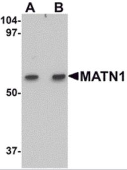 Western blot analysis of MATN1 in rat liver tissue lysate with MATN1 antibody at (A) 1 and (B) 2 μg/mL.