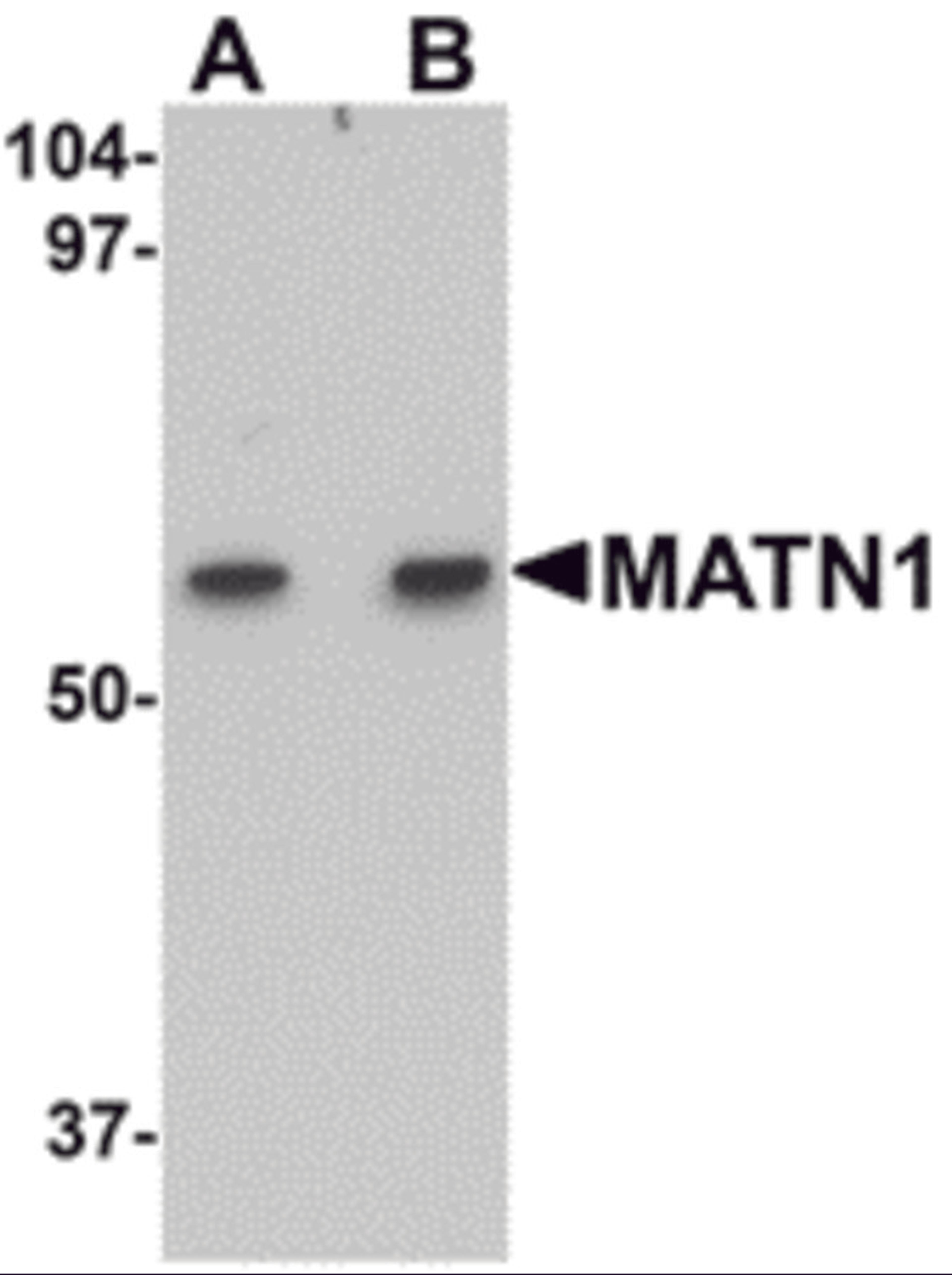 Western blot analysis of MATN1 in rat liver tissue lysate with MATN1 antibody at (A) 1 and (B) 2 μg/mL.